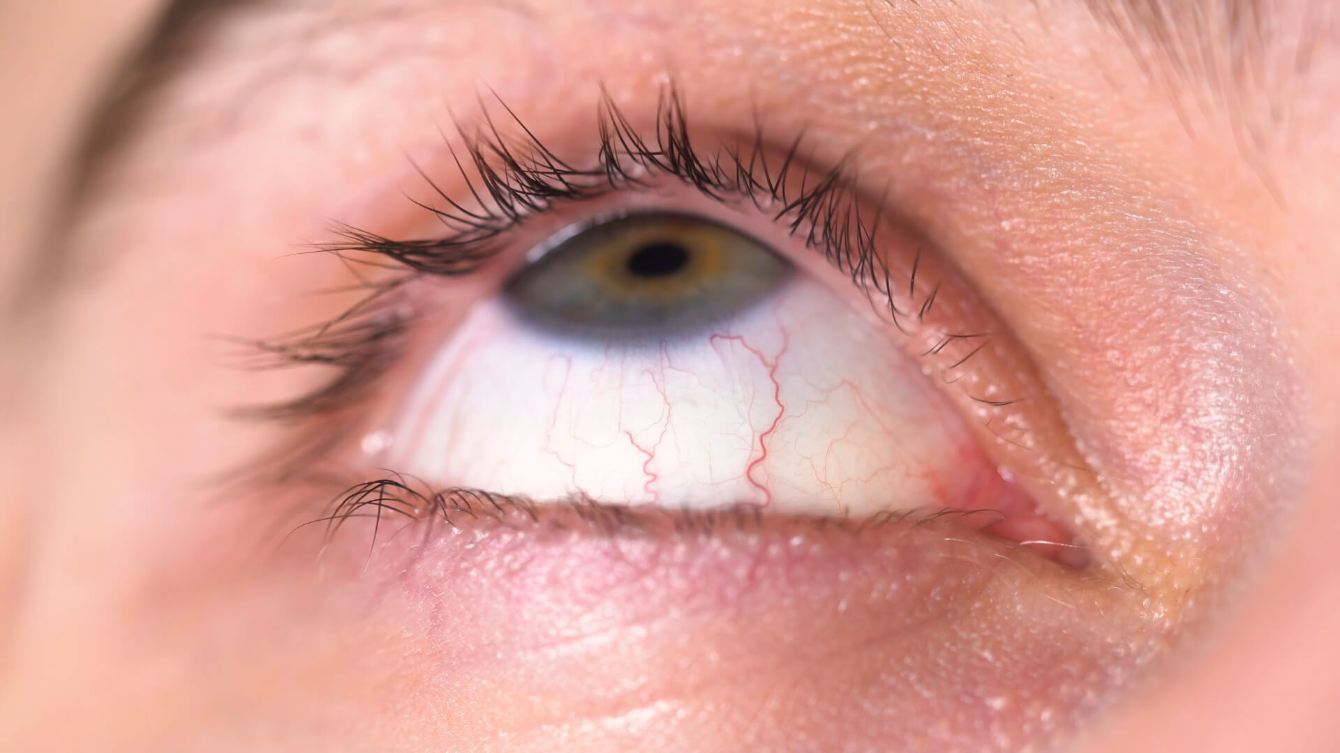 თვალების სიმშრალე და შფოთვითი ფიქრები შეიძლება ბევრად უფრო მჭიდროდ იყოს დაკავშირებული, ვიდრე გვგონია.